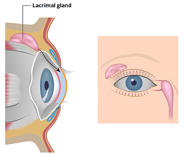 Lacrimal sac and tear duct anatomy illustrating blocked tear duct treated with lacrimal sac surgery in Dubai